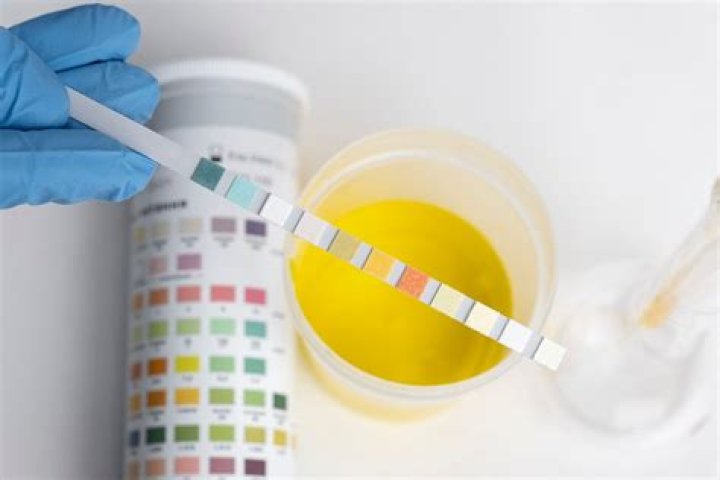 What color is hCG in urine?