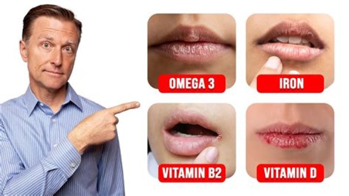 What deficiency causes dry lips?