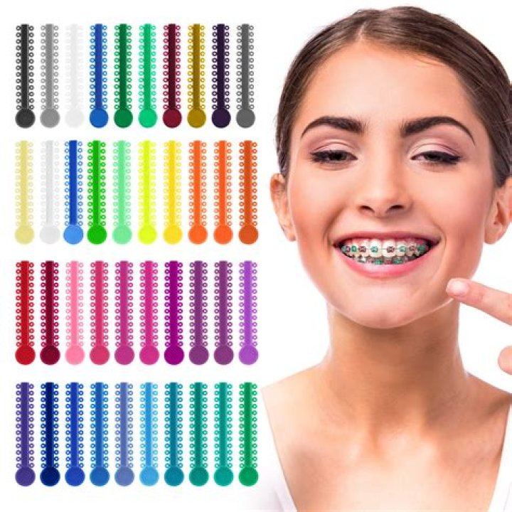 What do the colors on braces do?