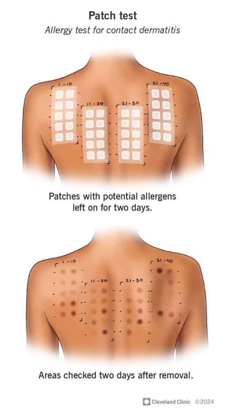 What does a 3 patch mean?
