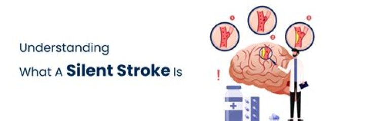 What does a silent stroke feel like?