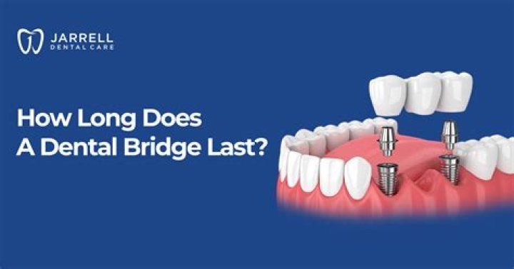 What does Alertable mean in bridge?