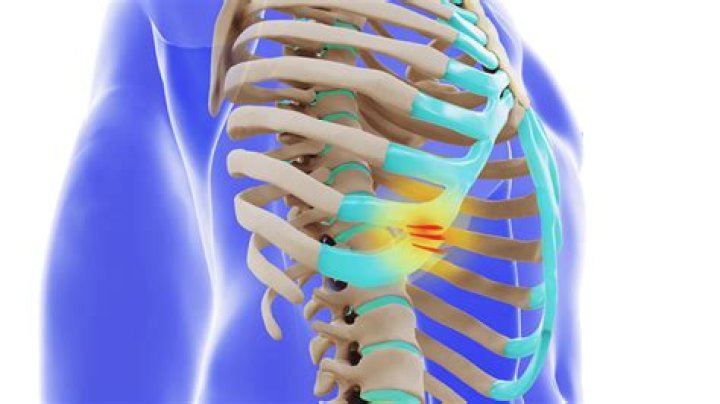 What does it mean when you feel a pop in your ribs?