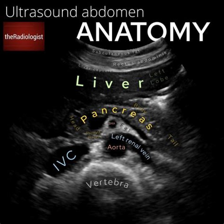 What does red mean on an abdominal ultrasound?