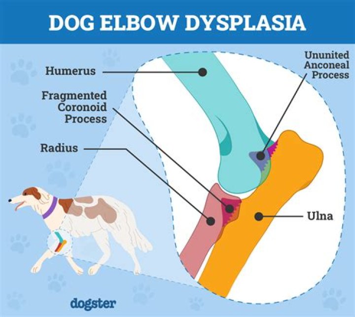What does vulvar dysplasia look like?