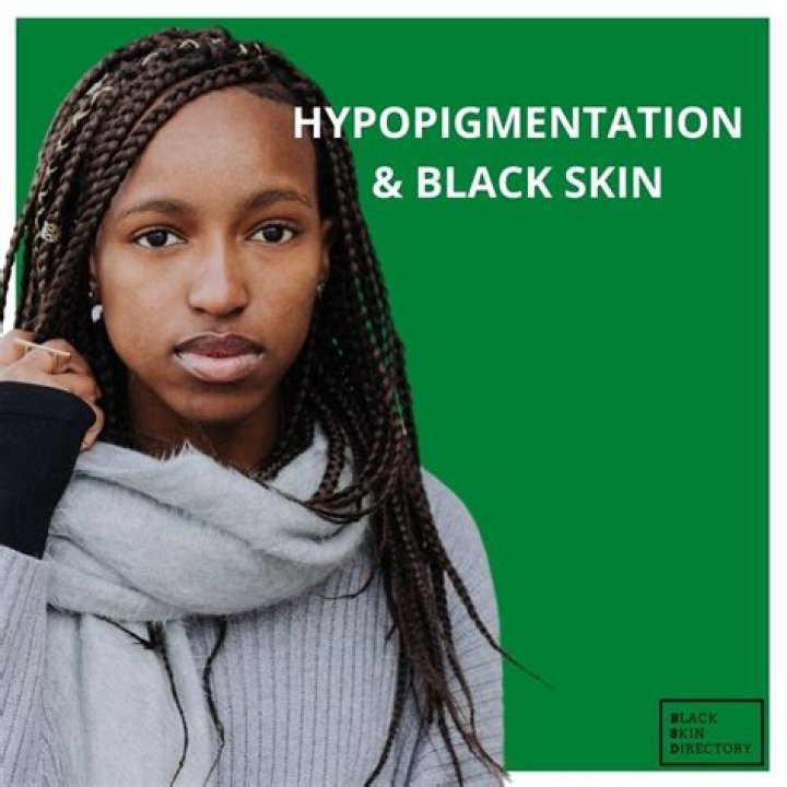 What foods help hypopigmentation?