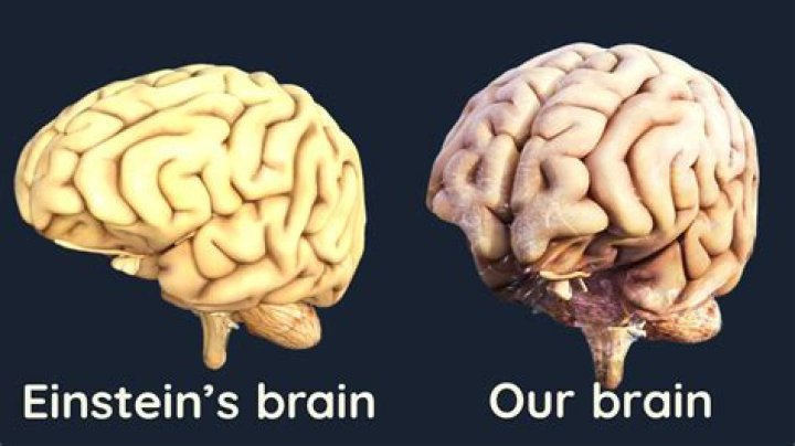 What happened to Albert Einstein's brain?