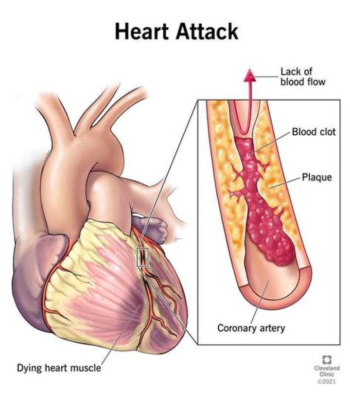 What happens if the heart muscle is damaged?