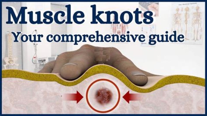 What happens to untreated muscle knots?