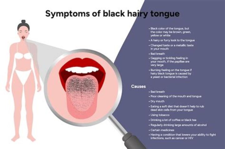 What is a black hairy tongue called?