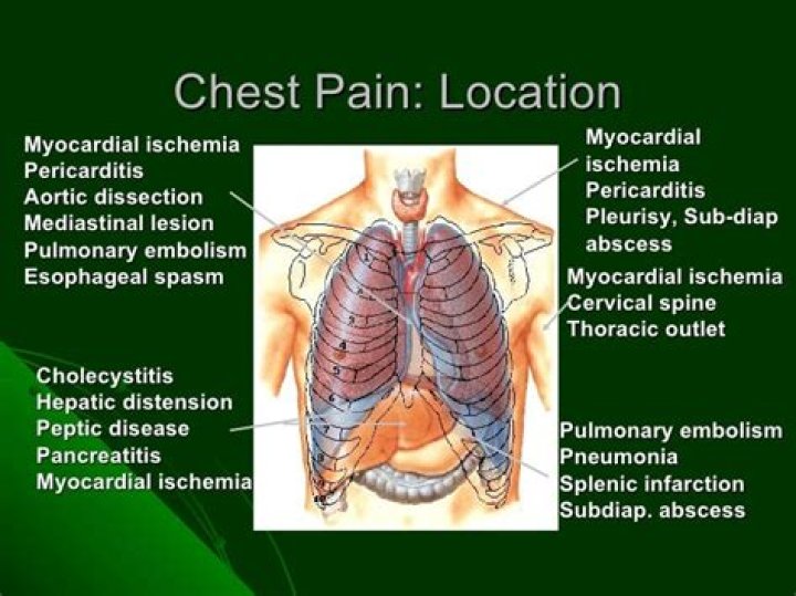What is a dull ache in the chest?