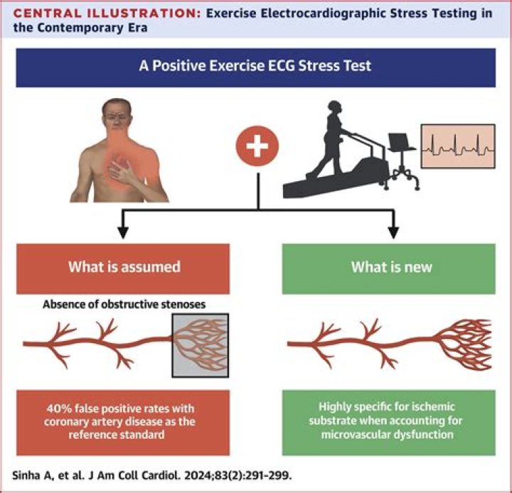 What is a positive stress test for ischemia?