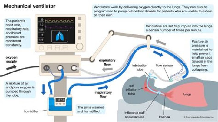 What is a ventilator machine?