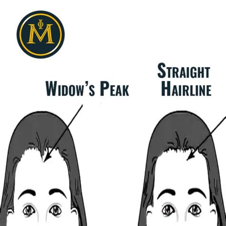 What is a widow's peak?