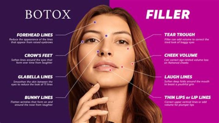 What is better than Botox for wrinkles?