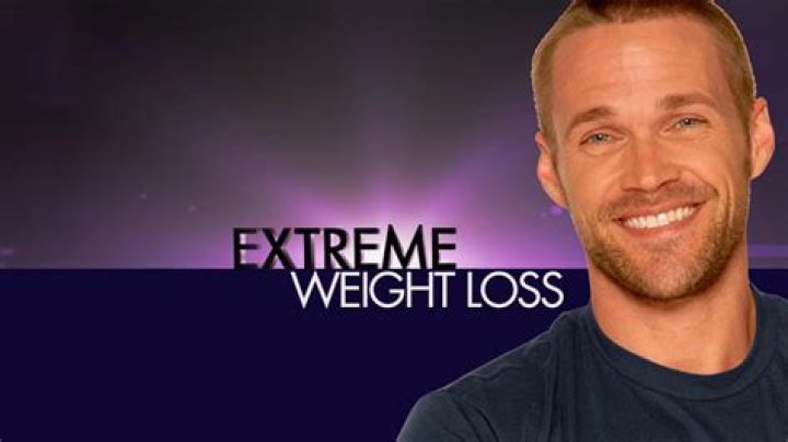 What is considered extreme weight loss?