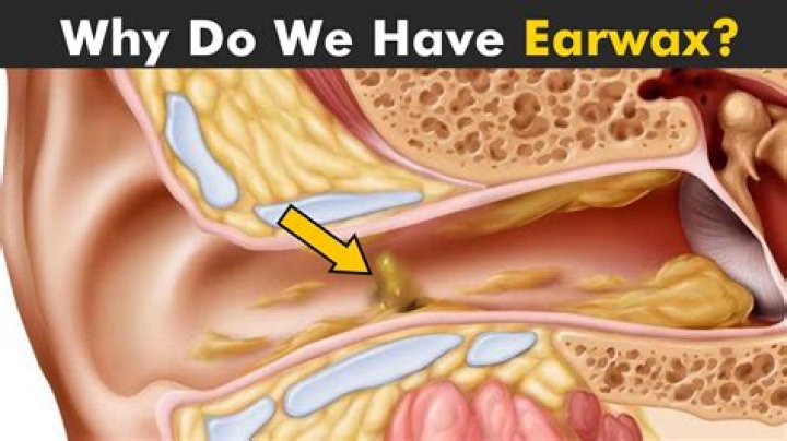 What is earwax made of?
