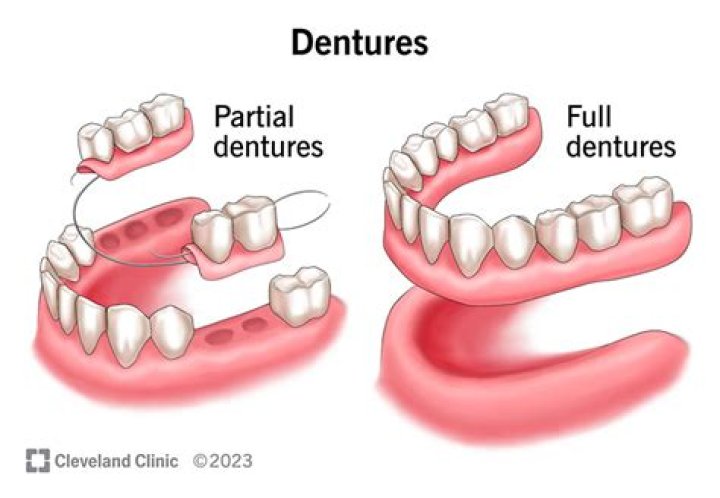 What is it like to wear dentures?