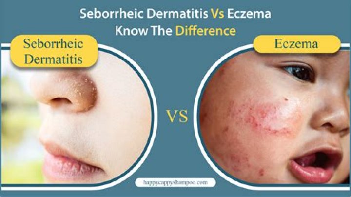 What is the difference between dermatitis and eczema?