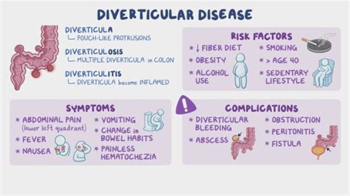 What is the difference between diverticulitis and diverticular disease?