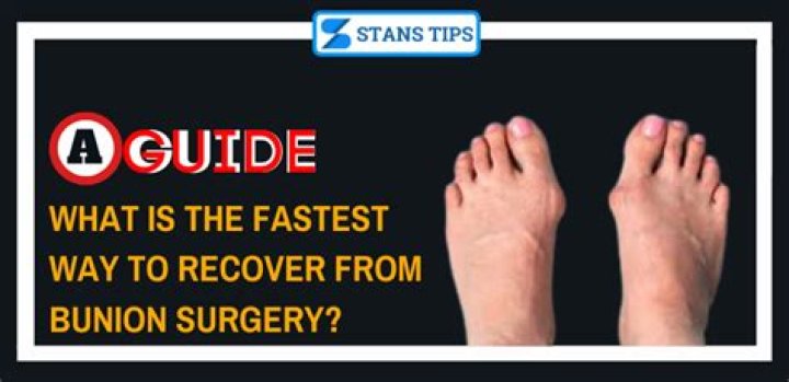 What is the fastest way to recover from bunion surgery?