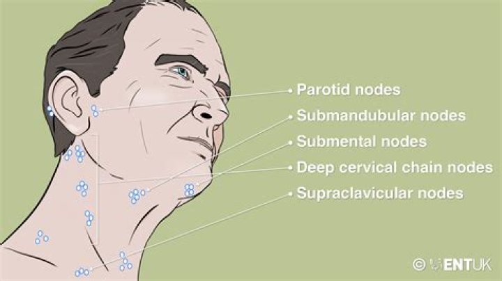 What is the size of lymph nodes in neck?