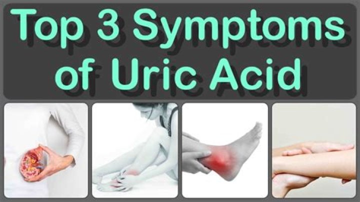 What is the symptoms of uric acid?