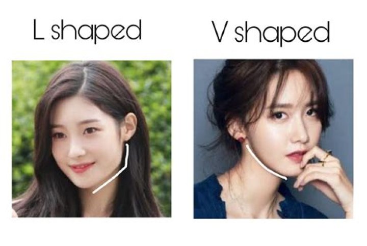 What is V-shaped jaw?