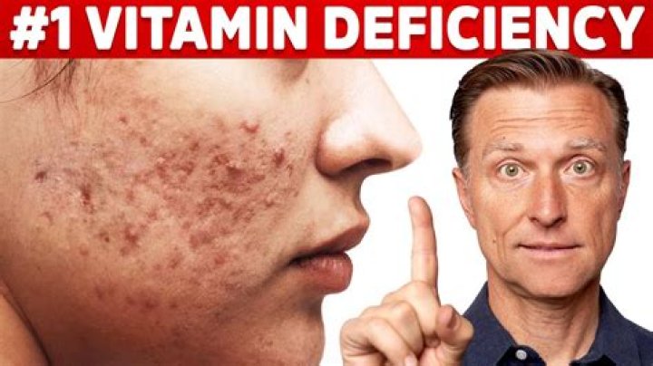 What lack of vitamin causes itchy skin?
