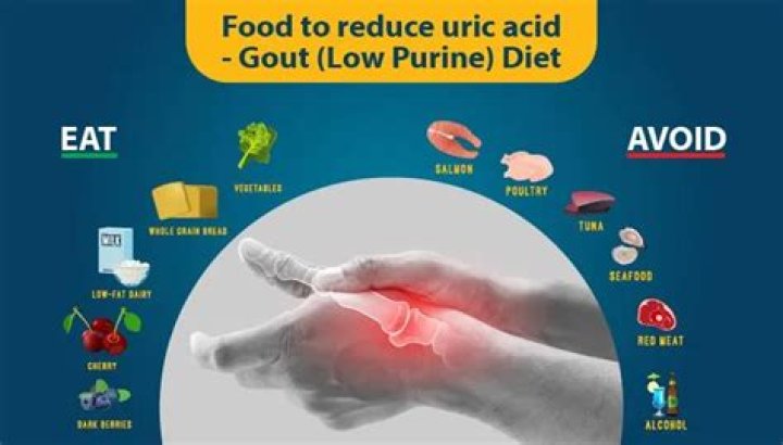 What level of uric acid is gout?