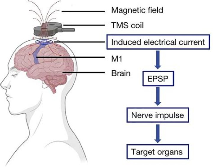 What part of the brain is affected by CFS?