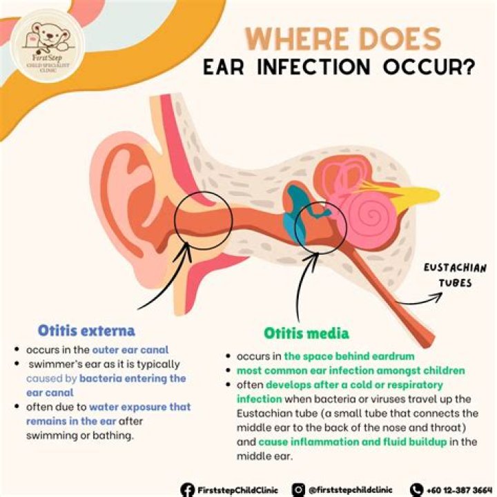 When is an ear infection serious?