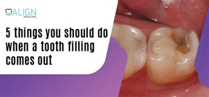 When should a tooth be pulled?