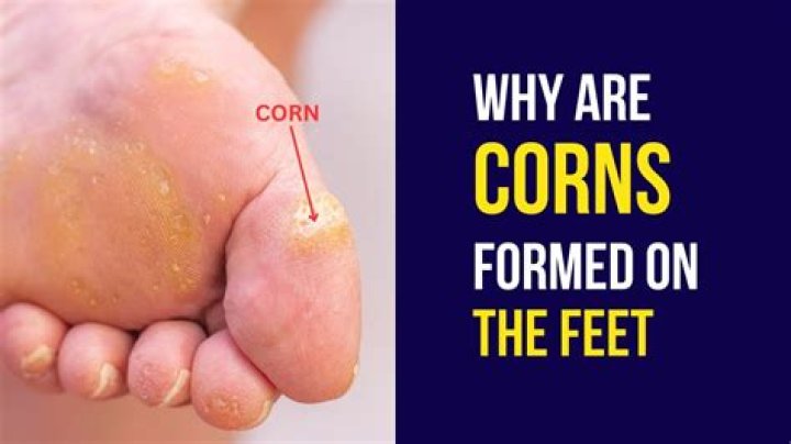 When should you put corn out for deer?