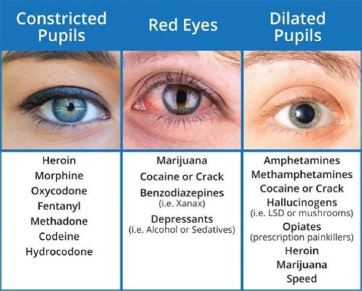 Which drugs cause glassy eyes?