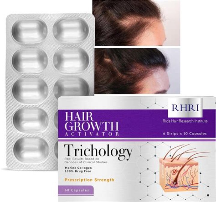 Which medicine is best for hair growth?