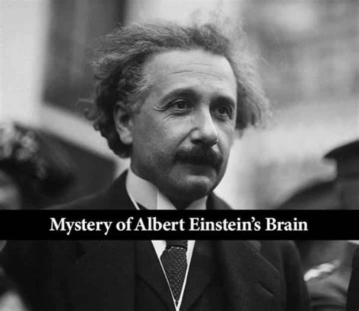 Who took Alberts brain?