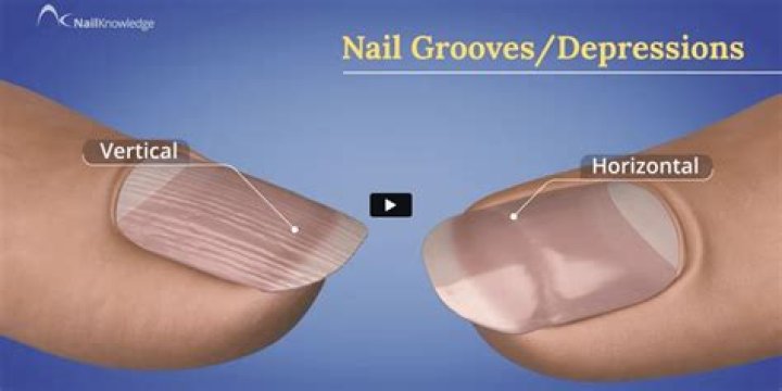 Why do I have grooves in my toenails?