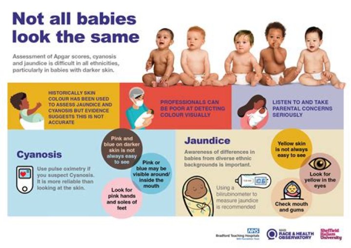 Why do newborns get scared while sleeping?