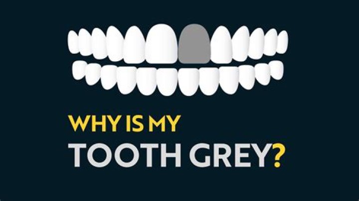 Why do teeth turn grey with age?