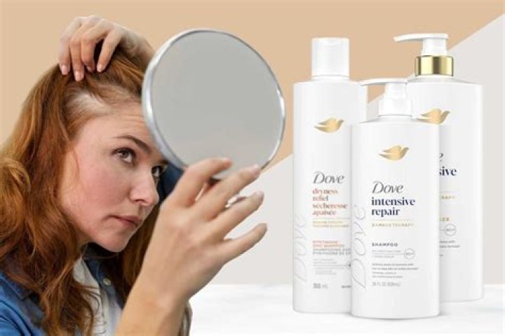 Why does Dove shampoo cause hair loss?