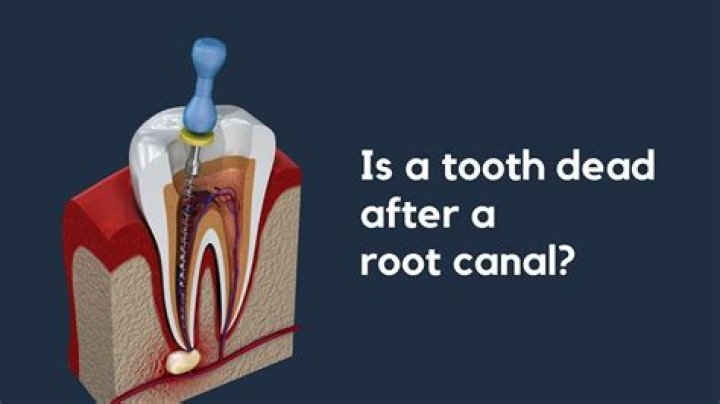 Why does the tooth next to my root canal hurt?