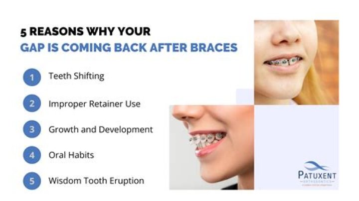 Why is my gap coming back after braces?