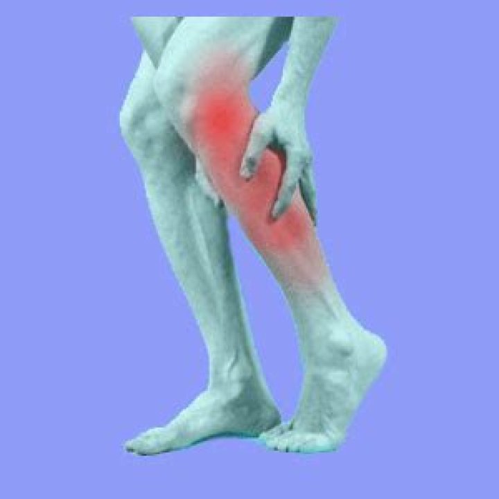 Will sciatica ever go away?